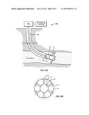 Method and Apparatus for Detection and Quantification of Borehole Standoff diagram and image