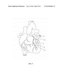 MEDICAL IMAGE PROCESSING SYSTEM, RECORDING MEDIUM HAVING RECORDED THEREON     A MEDICAL IMAGE PROCESSING PROGRAM AND MEDICAL IMAGE PROCESSING METHOD diagram and image