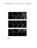 BIOMARKERS FOR T CELL MALIGNANCIES AND USES THEREOF diagram and image