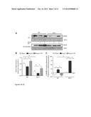 BIOMARKER FOR ABDOMINAL AORTIC ANEURYSM diagram and image