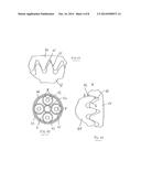 BACKLASH-FREE PLANETARY GEAR ASSEMBLY diagram and image