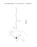 MICROWAVE ANTENNA APPARATUS, SYSTEMS, AND METHODS FOR LOCALIZING MARKERS     OR TISSUE STRUCTURES WITHIN A BODY diagram and image