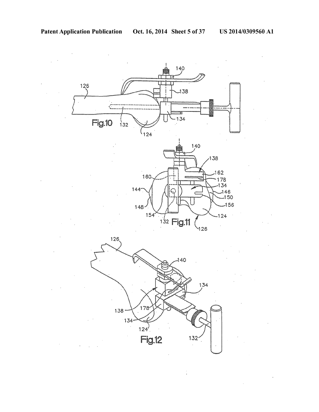 APPARATUS AND METHOD FOR MEASURING FORCES IN A KNEE JOINT - diagram, schematic, and image 06