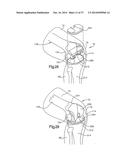 APPARATUS AND METHOD FOR MEASURING FORCES IN A KNEE JOINT diagram and image