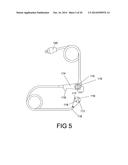 GASTROINTESTINAL PROSTHESES HAVING PARTIAL BYPASS CONFIGURATIONS diagram and image