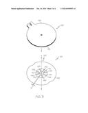 INFUSION SET WITH IMPROVED BORE CONFIGURATION diagram and image