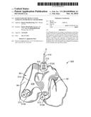 Patient-Specific-Bone-Cutting Guidance Instruments And Methods diagram and image