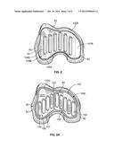 Patient-Specific-Bone-Cutting Guidance Instruments And Methods diagram and image