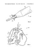 Patient-Specific-Bone-Cutting Guidance Instruments And Methods diagram and image