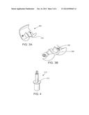 DISTAL FEMORAL TRIAL WITH REMOVABLE CUTTING GUIDE diagram and image