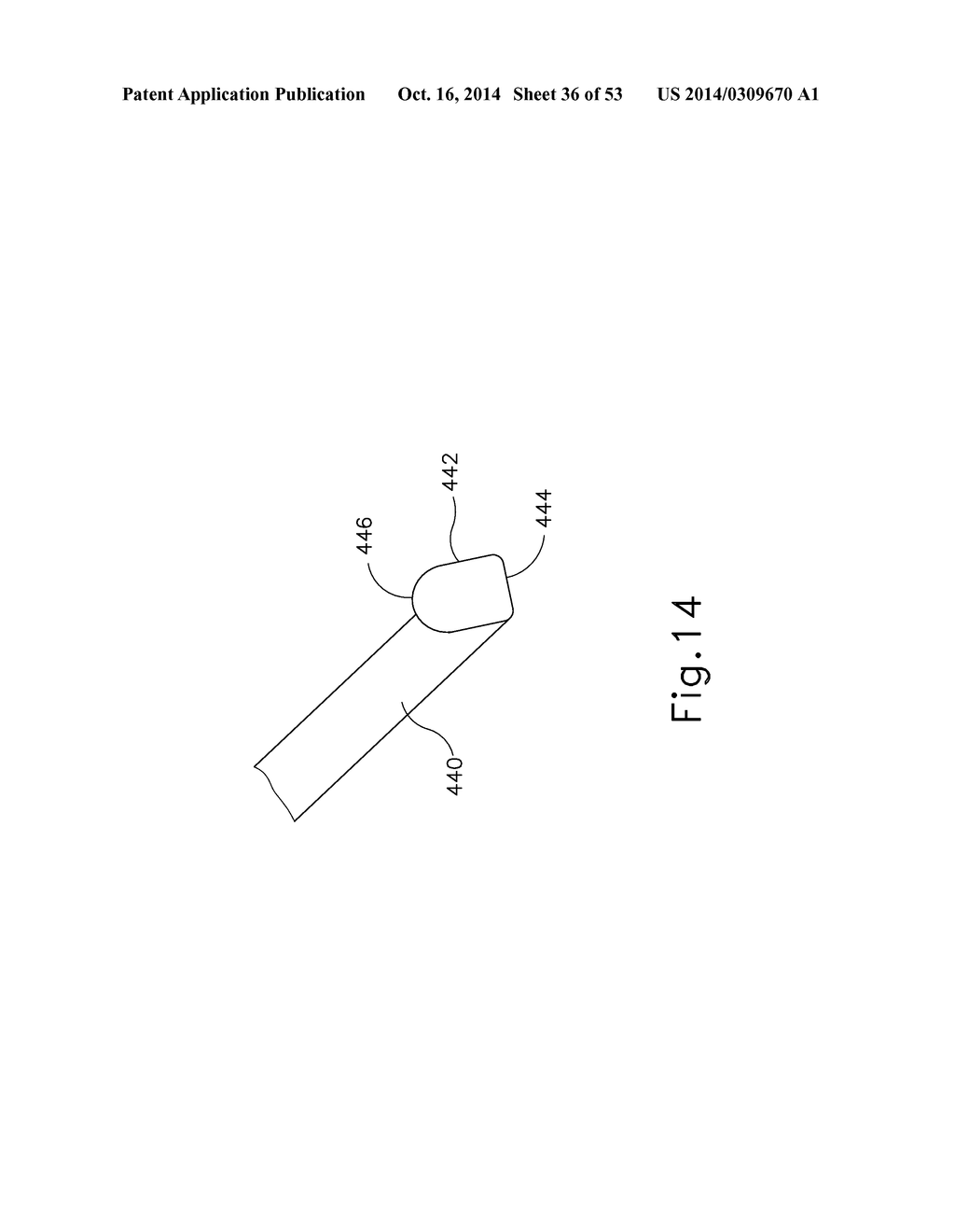 METHOD AND APPARATUS FOR JOINING HOLLOW ORGAN SECTIONS IN ANASTOMOSIS - diagram, schematic, and image 37