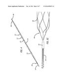 DEVICES FOR REMOVING VESSEL OCCLUSIONS diagram and image