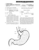 BARIATRIC DEVICE AND METHOD diagram and image