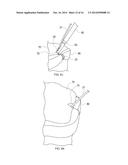 KNOTLESS FILAMENT ANCHOR FOR SOFT TISSUE REPAIR diagram and image