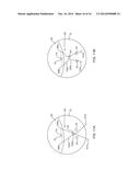 KNOTLESS FILAMENT ANCHOR FOR SOFT TISSUE REPAIR diagram and image