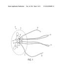 Suture System and Method diagram and image