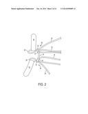 Suture System and Method diagram and image