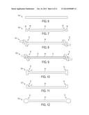 Suture System and Method diagram and image