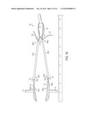 Suture System and Method diagram and image