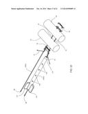 Suture System and Method diagram and image