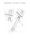 Suture System and Method diagram and image