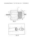 PELVIC CABLE SOLUTION diagram and image