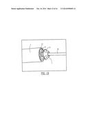 PELVIC CABLE SOLUTION diagram and image