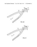 INTERSEGMENTAL MOTION PRESERVATION SYSTEM FOR USE IN THE SPINE AND METHODS     FOR USE THEREOF diagram and image