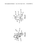 TELESCOPING INTERSPINOUS FIXATION DEVICE AND METHODS OF USE diagram and image