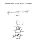 TELESCOPING INTERSPINOUS FIXATION DEVICE AND METHODS OF USE diagram and image