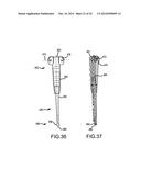 TELESCOPING INTERSPINOUS FIXATION DEVICE AND METHODS OF USE diagram and image