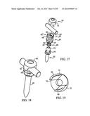 Polyaxial Screw diagram and image