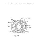 Polyaxial Screw diagram and image