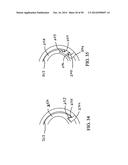 Polyaxial Screw diagram and image