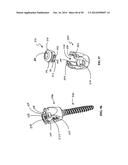 Polyaxial Screw diagram and image