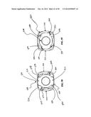 Polyaxial Screw diagram and image