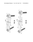 AUTOMATIC LENGTHENING BONE FIXATION DEVICE diagram and image