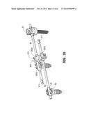 AUTOMATIC LENGTHENING BONE FIXATION DEVICE diagram and image