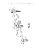 AUTOMATIC LENGTHENING BONE FIXATION DEVICE diagram and image