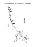 AUTOMATIC LENGTHENING BONE FIXATION DEVICE diagram and image