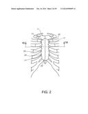 STERNUM FIXATION DEVICE AND METHOD diagram and image