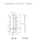 STERNUM FIXATION DEVICE AND METHOD diagram and image