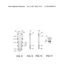 STERNUM FIXATION DEVICE AND METHOD diagram and image