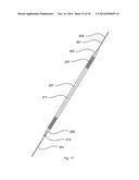 STERNUM FIXATION DEVICE AND METHOD diagram and image