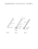 STERNUM FIXATION DEVICE AND METHOD diagram and image