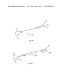 STERNUM FIXATION DEVICE AND METHOD diagram and image