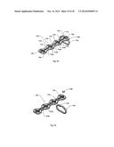 STERNUM FIXATION DEVICE AND METHOD diagram and image