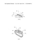 STERNUM FIXATION DEVICE AND METHOD diagram and image