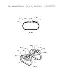 STERNUM FIXATION DEVICE AND METHOD diagram and image