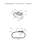 STERNUM FIXATION DEVICE AND METHOD diagram and image